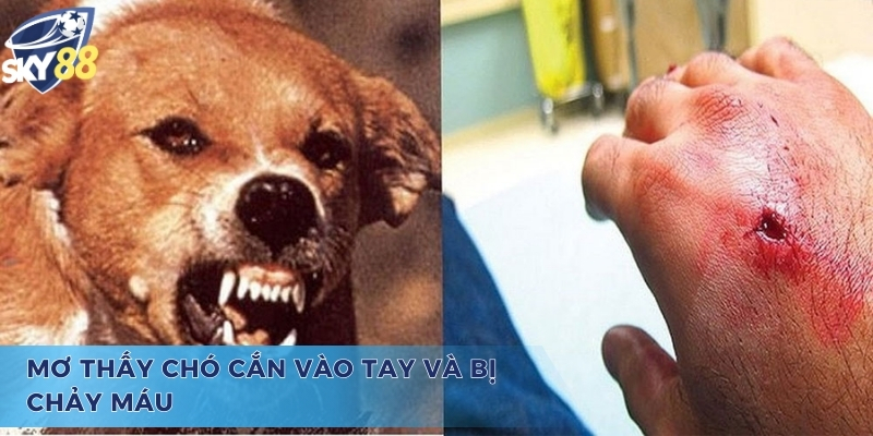 Tìm Hiểu Mơ Chó Cắn Vào Tay Đánh Con Gì Và Ý Nghĩa Đằng Sau Mơ chó cắn vào tay đánh con gì, bị chảy máu là tốt hay xấu